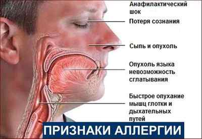 Що робити, якщо лоскоче в горлі і викликає кашель