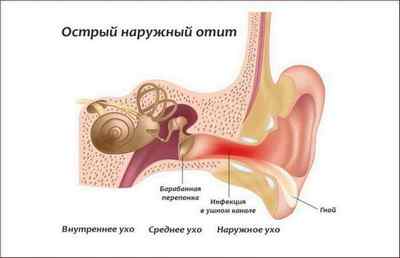 Що робити, якщо у дитини температура і болить вухо