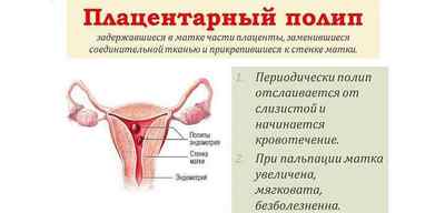 Що спричиняє формування плацентарного поліпа?