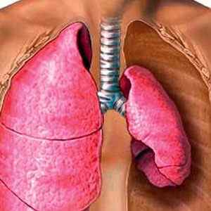 Що таке ателектаз легкого, його різновиди та лікування