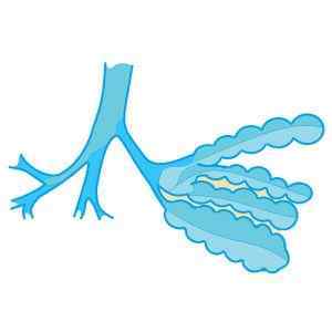 Що таке бронхоектази в легенях і як їх лікувати