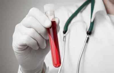 Що таке HBS аналіз крові на гепатит В