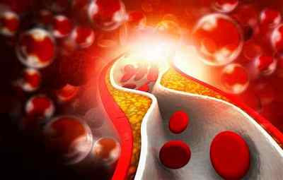 Що таке холестерин ЛПНЩ в біохімічному аналізі крові