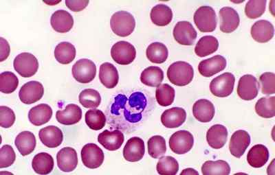 Що таке нейтрофіли в аналізі крові