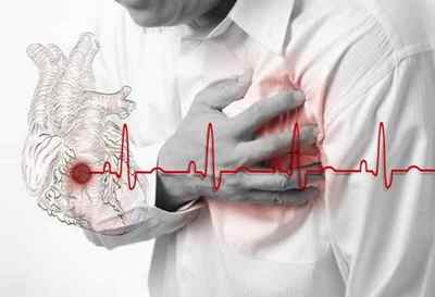Що таке нижній інфаркт міокарда і його симптоми