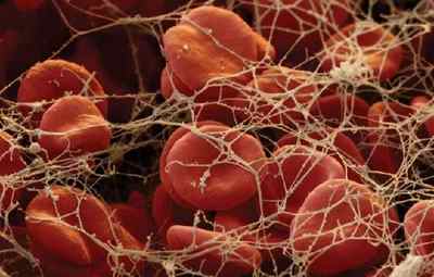 Що таке підвищений фібриноген в біохімічному аналізі крові
