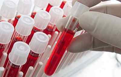 Що таке pdw або індекс розподілу тромбоцитів в аналізі крові