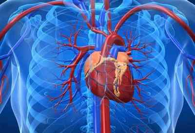 Що таке серцево-судинна дистонія