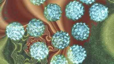 Що таке ВПЛ 59 типу, в чому особливість цього вірусу папіломи людини і як проходить його лікування?
