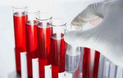 Що значить підвищений АЛТ в аналізі крові