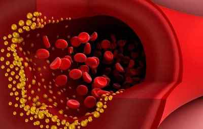 Що значить підвищення ЛПНЩ холестерину в крові