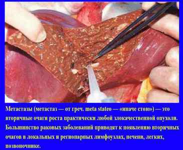 Сцинтиграфія нирок: динамічна і статична нефросцінтіграфія