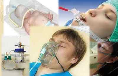 Сегментарна пневмонія у дорослих і дітей: симптоми, лікування