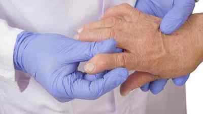 Серонегативний ревматоїдний артрит: можна вилікувати і що це таке, лікування народними засобами | Ревматолог
