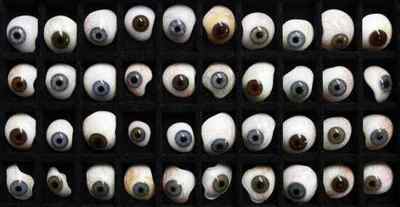 Штучне око для людини: види протезування, створення, як витягнути очної протез