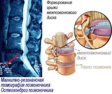Симптоми і лікування болю лівої нирки