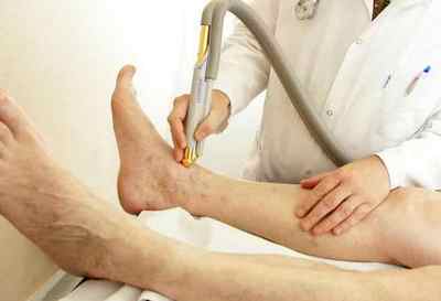 Симптоми і лікування ішемії нижніх кінцівок