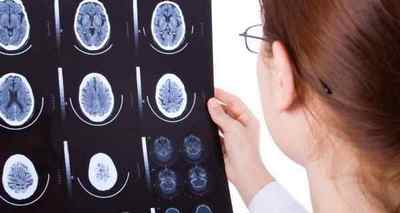 Симптоми і наслідки нейроінфекції мозку, її код за МКХ-10