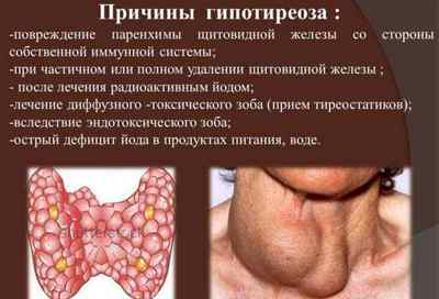 Симптоми захворювання щитовидної залози у чоловіків і лікування