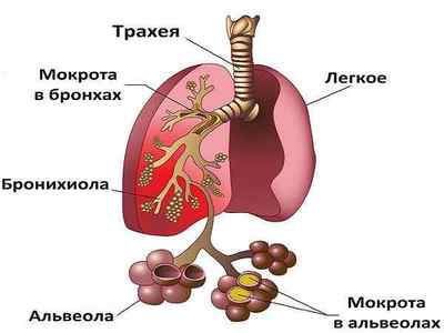 Симптоми запалення легенів у дітей