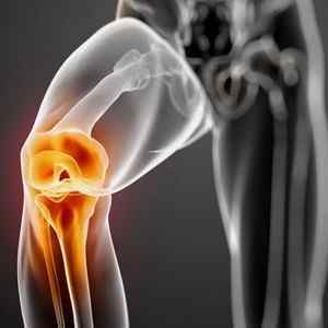 Синдром коліна бігуна: симптоми і лікування, як лікувати | Ревматолог