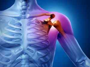 Синовит плечового суглоба: що це таке, симптоми і лікування рідини в плечовому суглобі, причини виникнення | Ревматолог