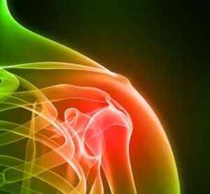 Синовит плечового суглоба: що це таке, симптоми і лікування рідини в плечовому суглобі, причини виникнення | Ревматолог