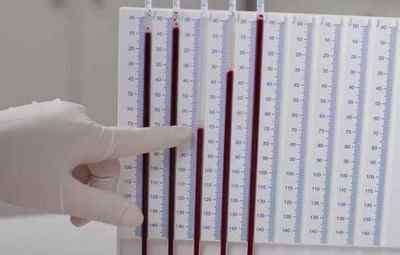 Скільки ШОЕ в аналізі крові при онкології