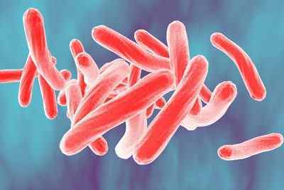 Скільки триває інкубаційний період туберкульозу легенів