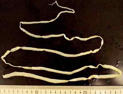 Солітер червяк в організмі: що це таке, ознаки та фото, симптоми