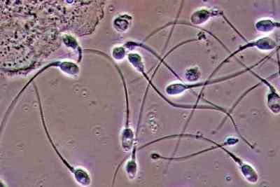 Сперма під мікроскопом: фото і відео з коментарями