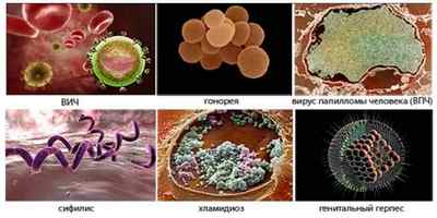 Список венеричних захворювань: найпоширеніші види.