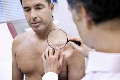 Способи лікування ВПЛ у чоловіків: препарати і особливості їх застосування