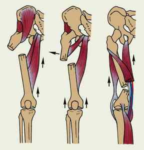 Стегнова кістка - анатомія і пошкодження