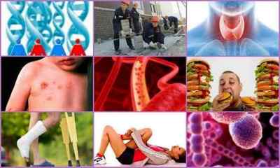 Субхондральний остеосклероз: причини, симптоми, лікування