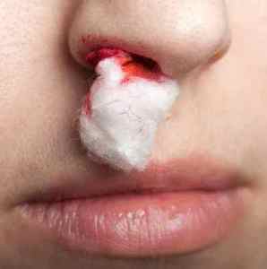 Судинорозширювальні краплі в ніс: список препаратів і їх дія