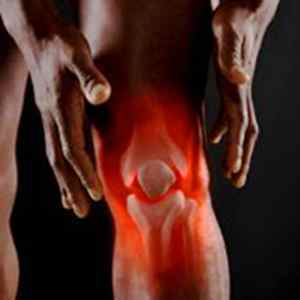 Суглобова миша колінного суглоба: симптоми і лікування без операції народними засобами, рентген внутрішньосуглобової миші, МКБ-10 | Ревматолог