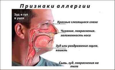 Сверблячка в носі і чхання: причини і методи лікування
