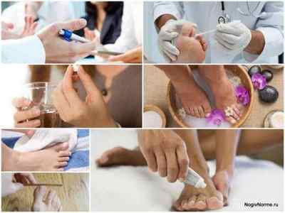 Таблетки Флуконазол від грибка нігтів на ногах: інструкція із застосування, ціна, відгуки, аналоги