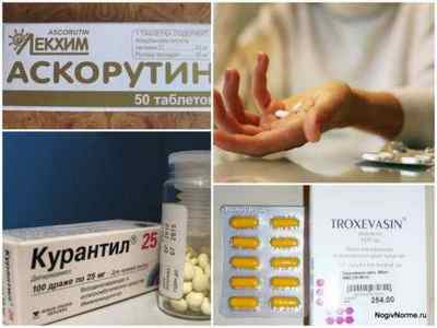 Таблетки від варикозу вен на ногах: список кращих препаратів, ціни, відгуки