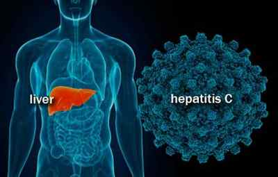 Таблиця розшифровки кількісного аналізу на гепатит С