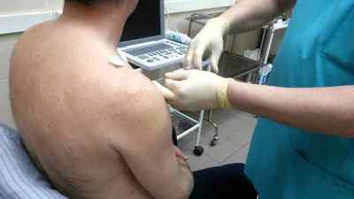 Тендиніт сухожилля надостной мязи плечового суглоба: лікування, тендовагініт плечового суглоба, кальцифікуючий тендиніт | Ревматолог