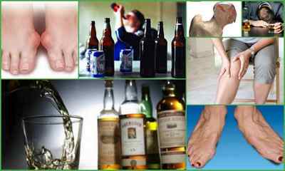 Алкоголь і суглоби - чи можуть хворіти після вживання