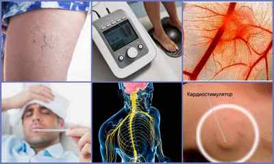 Апарати для лікування суглобів в домашніх умовах: ультразвук, лазер, магнітотерапія та інші методики