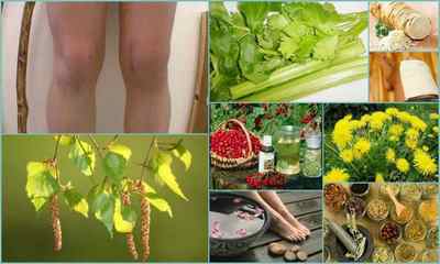 Артроз колінного суглоба - лікування народними засобами в домашніх умовах, відгуки