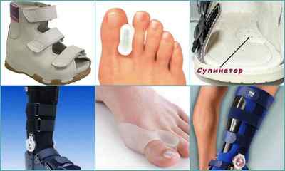 Артроз великого пальця ноги: лікування, симптоми, фото, відгуки