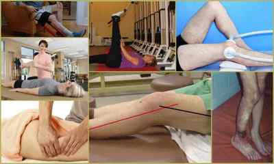 Болі після ендопротезування кульшового та колінного суглобів - чому болить коліно, під пятою, як лікувати