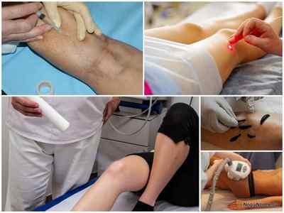 Червоні плями на ногах при варикозі - фото і лікування
