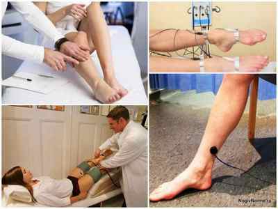 Діагностика варикозу вен на ногах: види досліджень, де пройти, як проводиться