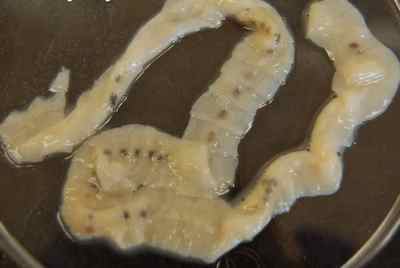 Довгі глисти у людини: найдовший паразит в організмі, стрічковий червяк, симптоми гельмінтів